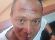 Bantu Selesaikan Persoalan Kecelakaan, Pimpinan Redaksi BantenNet Malah Dianiaya